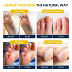 FOOT CURE Citrus Detox Foot Soak - Image 4