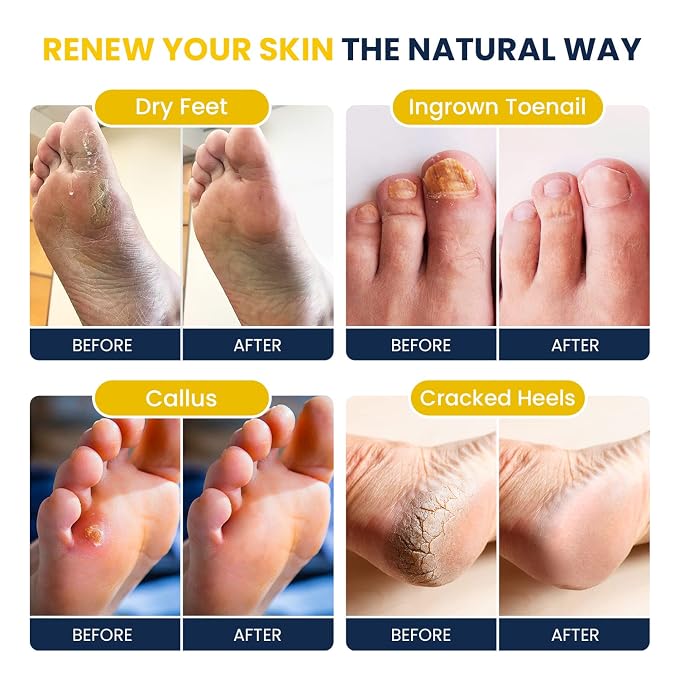 FOOT CURE Citrus Detox Foot Soak - Image 4