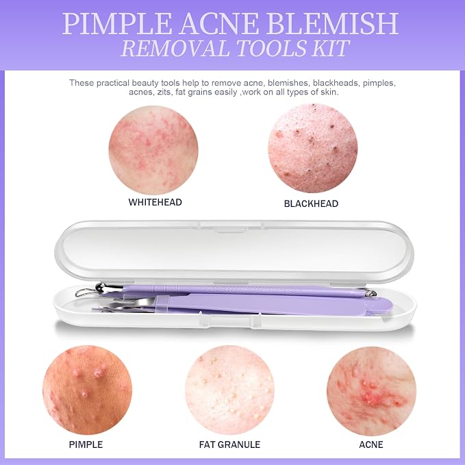 Teenitor Pimple Popper Tool Kit and Blackhead Remover Tools, Ingrown Hair - Image 7