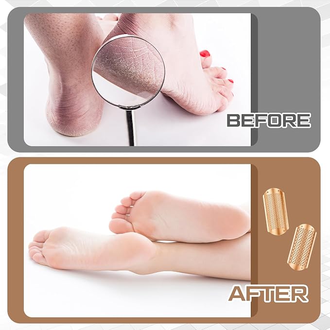 Moxweyeni 8 Pack Rose Gold Foot File Callus Remover Replacement Blades Metal - Image 5