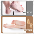 Moxweyeni 8 Pack Rose Gold Foot File Callus Remover Replacement Blades Metal - Image 5