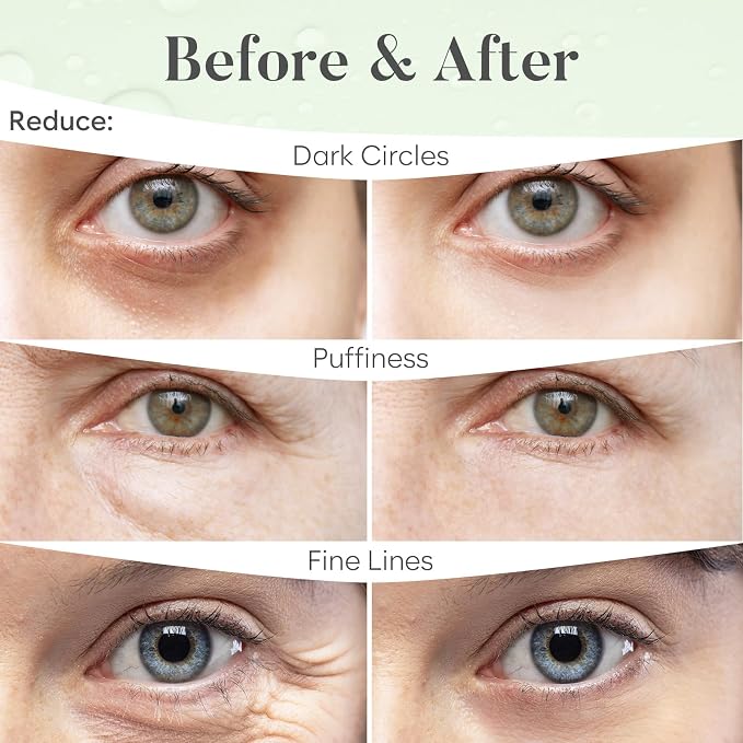 BLOOMORA Green Tea Under Eye Patches - Image 4
