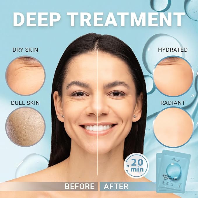 VIABEAUTY 24 Pack of Hyaluronic Acid Face Mask - Image 2