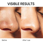 SKINTIFIC Deep Pore Cleansing Blackhead Remover Face Mask Stick, Mud Mask - Image 4