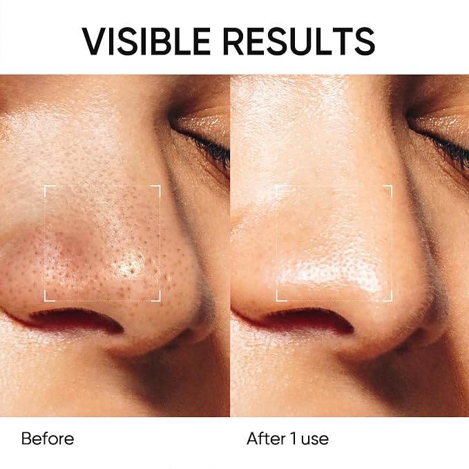 SKINTIFIC Deep Pore Cleansing Blackhead Remover Face Mask Stick, Mud Mask - Image 4