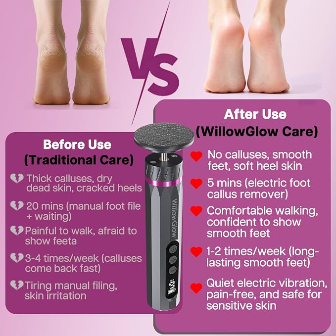 Professional Electric Foot Callus Remover, 9-Speed Cordless Foot File - Image 4