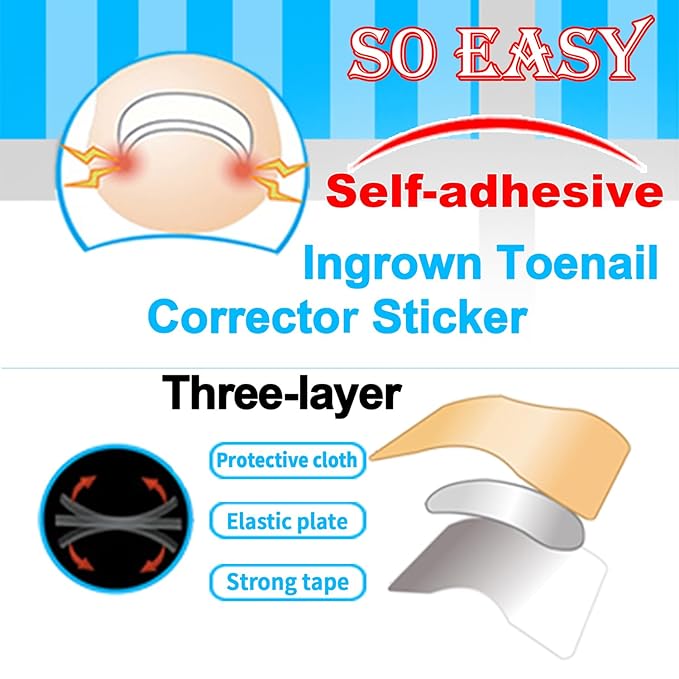 Professional Ingrown Toenail Correction Kit - Image 7