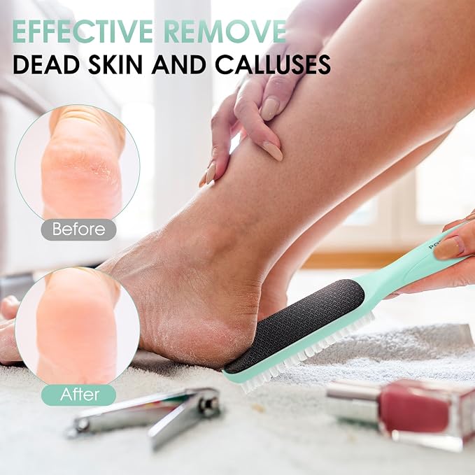Foot File Callus Remover - Image 4