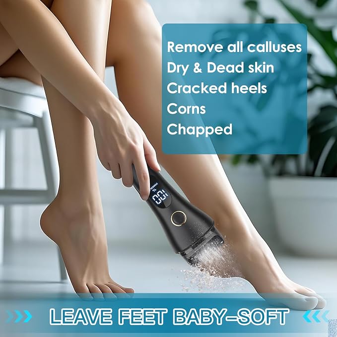 Electric Foot File Callus Remover - Image 6