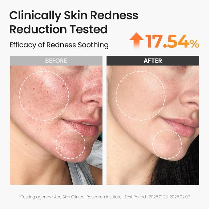 SKINFOOD Carrot Toner Pads, Instant Cooling & Redness Relief, After Sun Care - Image 4