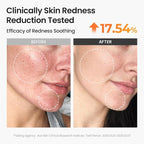 SKINFOOD Carrot Toner Pads, Instant Cooling & Redness Relief, After Sun Care - Image 4