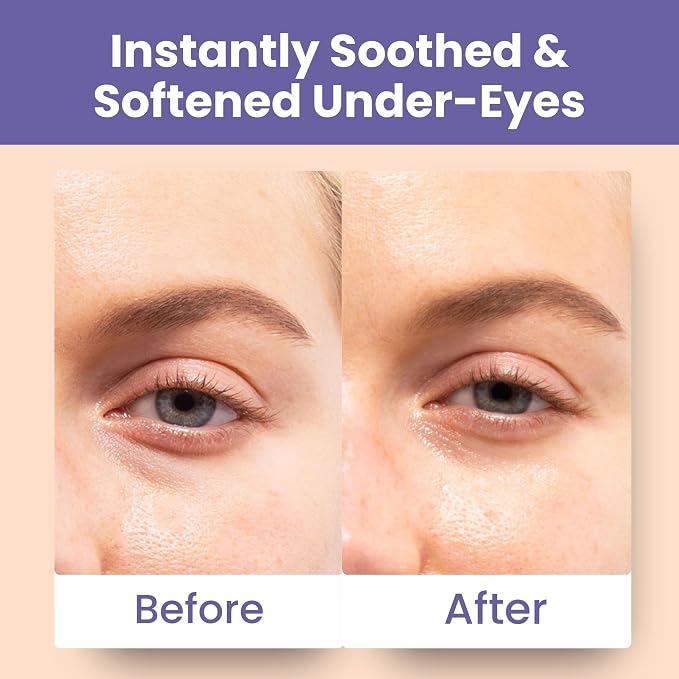 Patchology Skin Remedy Soothing Eye Gels – Ultra-Soft Hydrogel Undereye Masks - Image 7