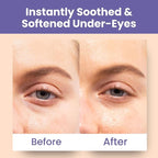 Patchology Skin Remedy Soothing Eye Gels – Ultra-Soft Hydrogel Undereye Masks - Image 7