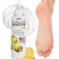 DeEnti Callus Remover for Feet, Extra Strength Foot Callus Remover Gel by DeEnti