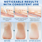60% Urea Stick with 2% Salicylic Acid, Maximum Strength Callus Remover & - Image 4