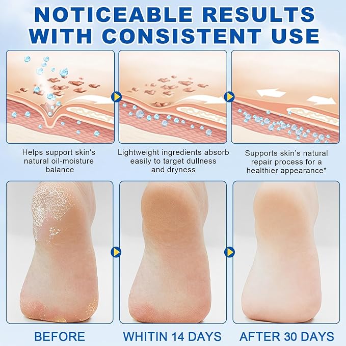 60% Urea Stick with 2% Salicylic Acid, Maximum Strength Callus Remover & - Image 4