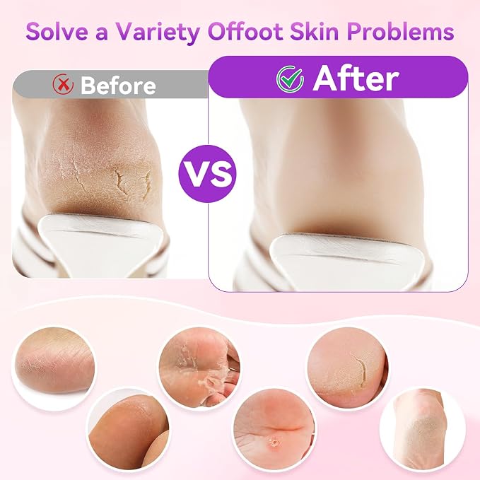 FAMILIFE Electric Foot File Callus Remover – Rechargeable Pedicure Tool - Image 9