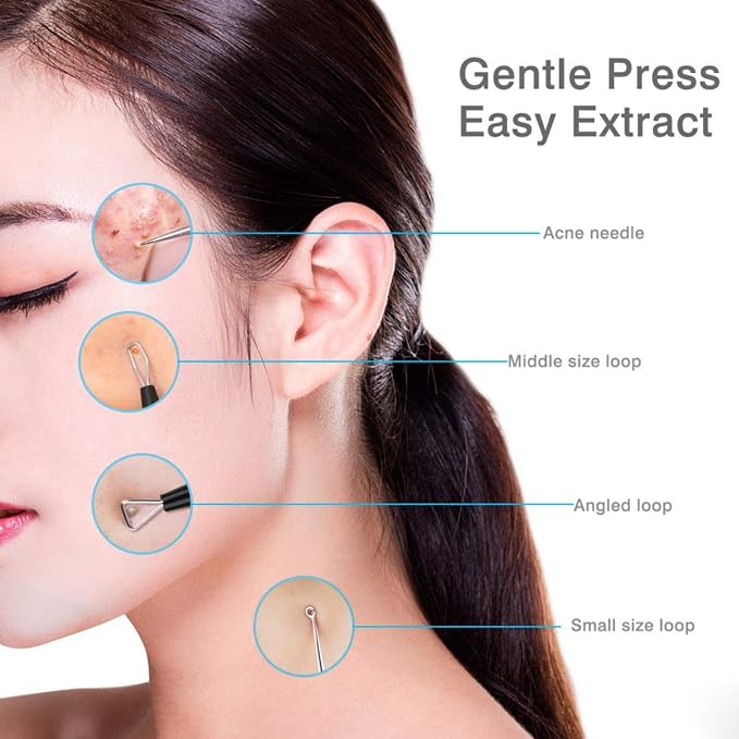JPNK Blackhead Remover Tool Comedones Extractor Acne Removal Kit - Image 5