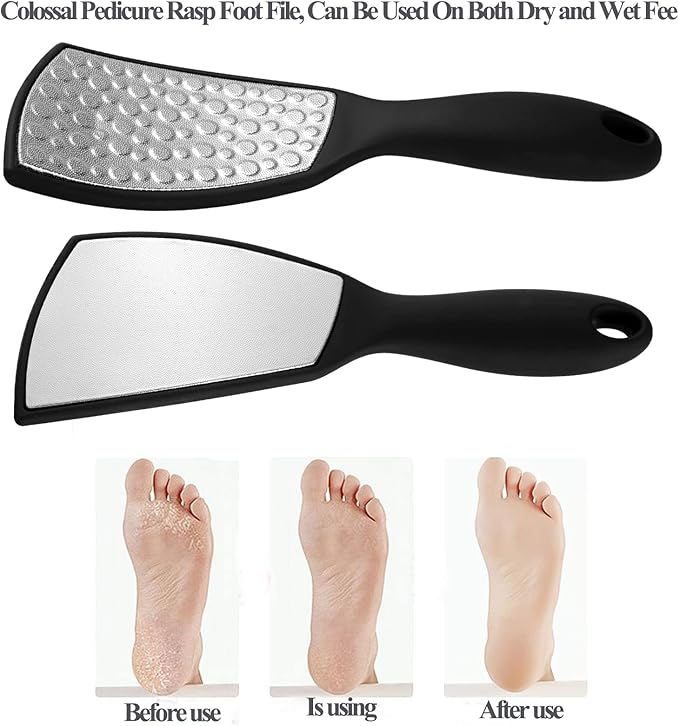 Foot Rasp Foot File and Callus Remover, Best Foot Care Pedicure Metal Surface - Image 6