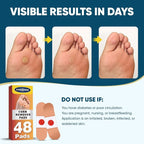 48P Corn Remover Pads for Feet and Toes, Extra Strength 40% Salicylic Acid - Image 4