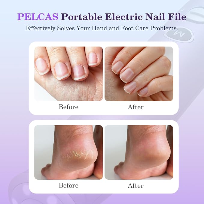 PELCAS Electric Nail Drills, 10 Speeds Cordless Nail File - Image 2
