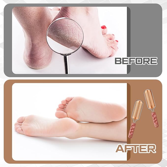 Moxweyeni 14 Pack Colossal Foot File Pedicure Tool Set - Image 5