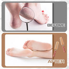 Moxweyeni 14 Pack Colossal Foot File Pedicure Tool Set - Image 5