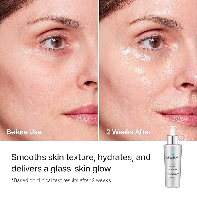 REJURAN® Turnover Ampoule, c-PDRN® – Original Salmon DNA PDRN Face Serum - Image 5