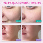 YEOUTH Skin Care Set: Hyaluronic Acid Serum - Image 3