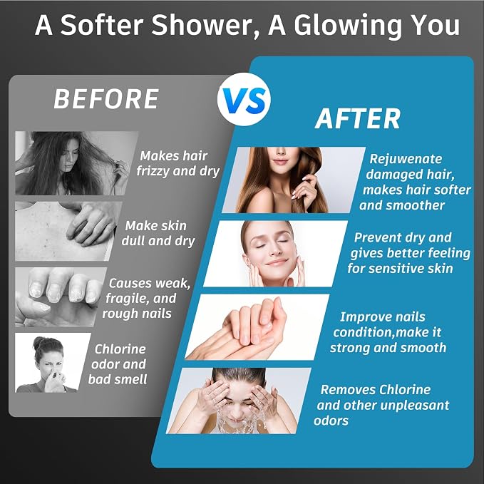 FEELSO Filtered Shower Head, High Pressure 6 Spray Modes Shower Head - Image 5