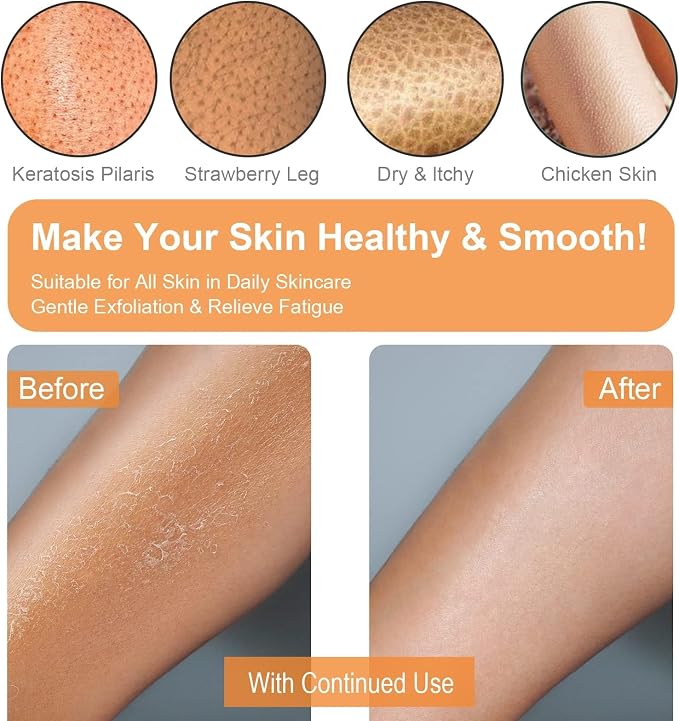 Exfoliating Gloves 2 Pcs, Exfoliating Body Scrubber - Image 3