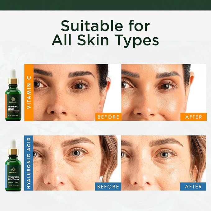 Tree of Life Beauty Facial Skin Care Set, Brightening, Dry Face, Dermatologist - Image 3