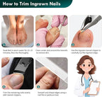 5-in-1 Professional Ingrown Toenail Tools Kit, Wide Jaw Slanted Nail Clippers & - Image 9