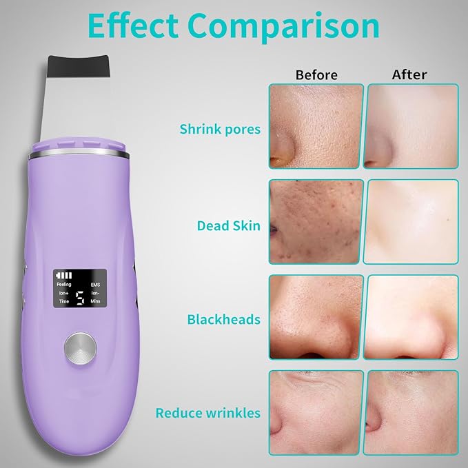 Face Scrubber Skin Spatula - Image 4