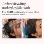 MDhair Mounted & Handheld Filtered Showerhead Bundle - Image 6