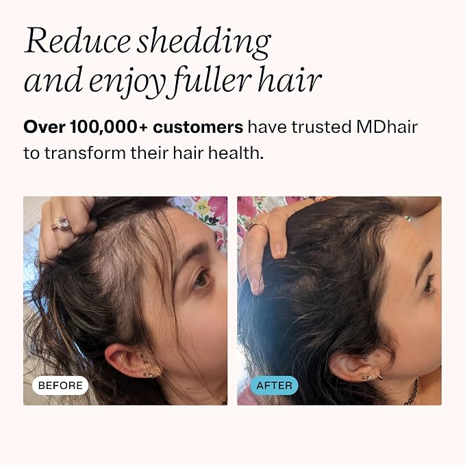 MDhair Mounted & Handheld Filtered Showerhead Bundle - Image 6