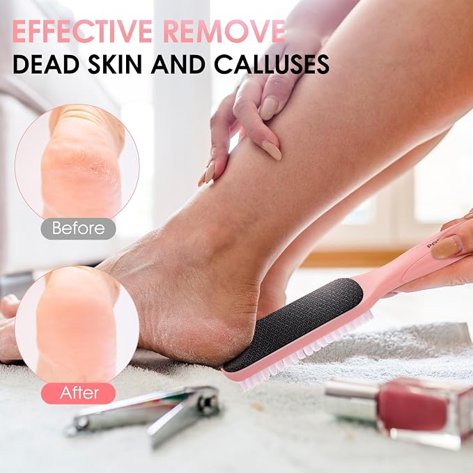 Foot File Callus Remover - Image 4
