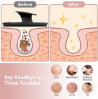 Silicone Face Scrubber 2 Pack, Manual Facial Cleansing Brush - Image 5