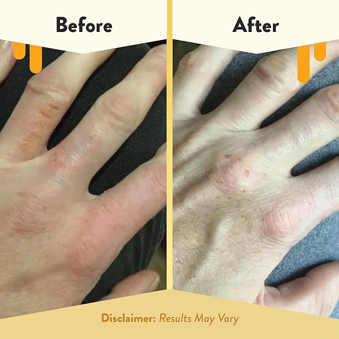 ECZEMA HONEY Oatmeal Hand Cream - Image 4