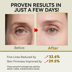 PDRN Under Eye Patches, 25 Pairs Retinol & Caffeine Eye Mask, Collagen - Image 3
