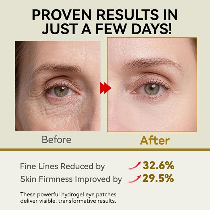 PDRN Under Eye Patches, 25 Pairs Retinol & Caffeine Eye Mask, Collagen - Image 3