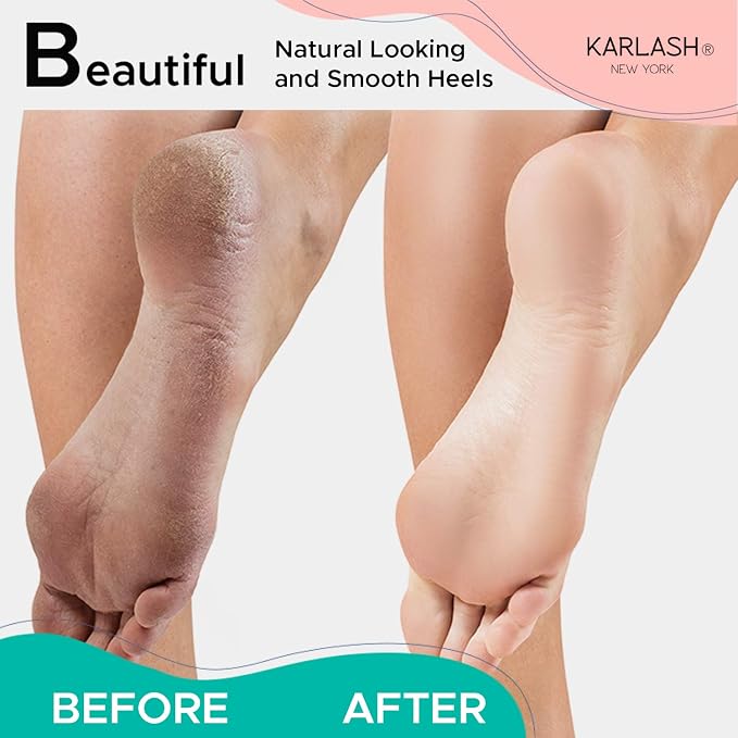 Karlash Professional Pedicure Foot Pumice Stone - Image 4