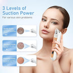 Facial Pore Blackhead Remover Vacuum, 1080P Camera Blackhead Remover, 20x Zoom - Image 3
