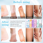 Pedicure Foot Soak Set - Image 3