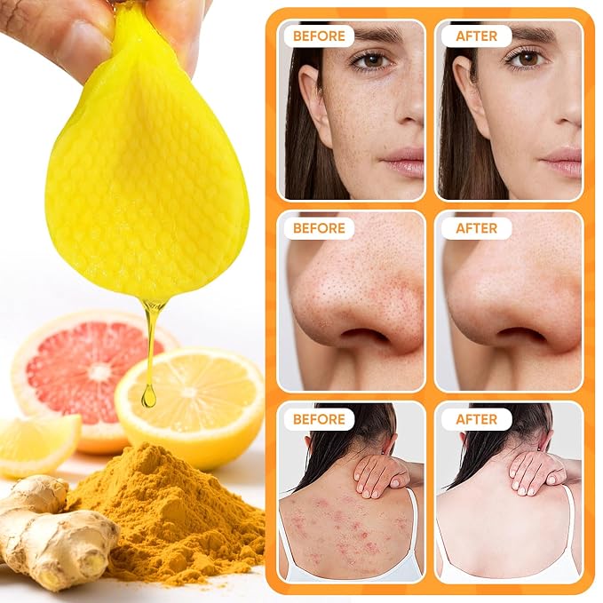 Turmeric Cleansing Pads 50 Pcs+Tumeric Soap Bar+Tumeric Face Wash - Image 2