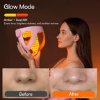 INIA Glow 4D Wireless Red Light Therapy Mask - Image 6