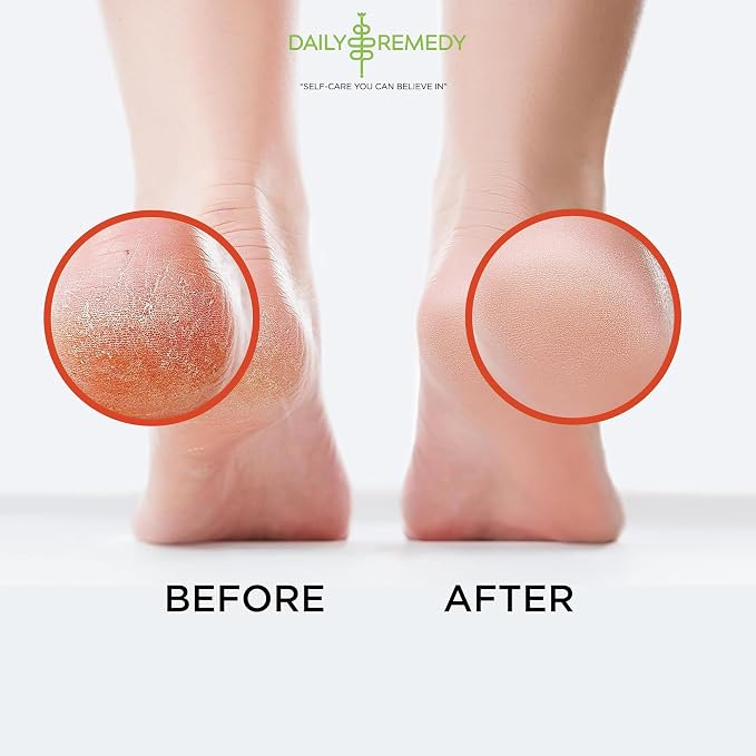 Muscle Relief Foot Soak with Epsom Salt, Made in USA, Soothe Tired Feet - Image 5