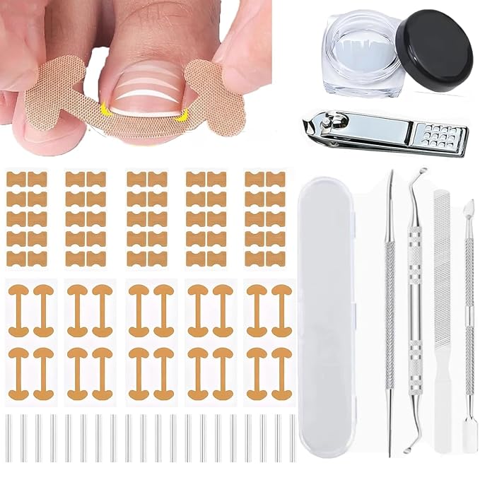 Ingrown Toenail Corrector Set by Unknown
