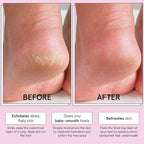 grace & stella Award-Winning Foot Peel Mask - Image 3
