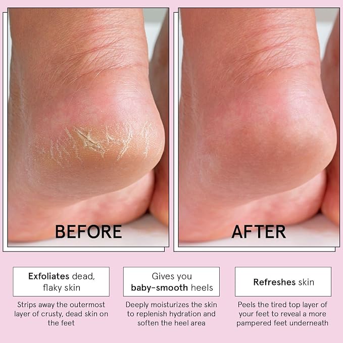 grace & stella Award-Winning Foot Peel Mask - Image 3